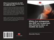 Capa do livro de Effets d'un antagoniste des BMP sur la guérison des fractures dans un modèle de souris 