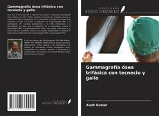 Bookcover of Gammagrafía ósea trifásica con tecnecio y galio