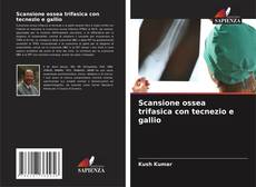 Buchcover von Scansione ossea trifasica con tecnezio e gallio