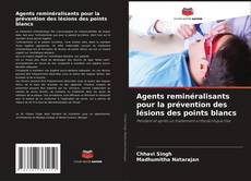 Buchcover von Agents reminéralisants pour la prévention des lésions des points blancs