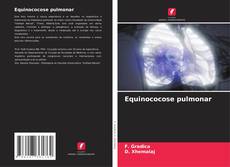 Copertina di Equinococose pulmonar