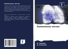 Buchcover von Эхинококкоз легких