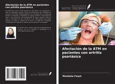 Afectación de la ATM en pacientes con artritis psoriásica kitap kapağı