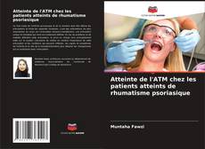 Bookcover of Atteinte de l'ATM chez les patients atteints de rhumatisme psoriasique