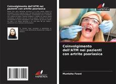 Bookcover of Coinvolgimento dell'ATM nei pazienti con artrite psoriasica