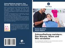 Bookcover of Zahnaufhellung meistern: Das Warum, Wann und Wie verstehen