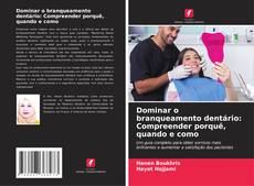 Copertina di Dominar o branqueamento dentário: Compreender porquê, quando e como