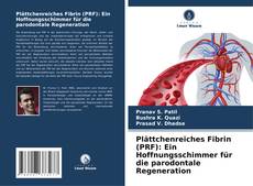 Bookcover of Plättchenreiches Fibrin (PRF): Ein Hoffnungsschimmer für die parodontale Regeneration