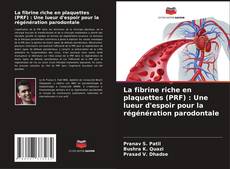 Bookcover of La fibrine riche en plaquettes (PRF) : Une lueur d'espoir pour la régénération parodontale