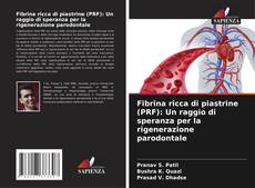 Capa do livro de Fibrina ricca di piastrine (PRF): Un raggio di speranza per la rigenerazione parodontale 