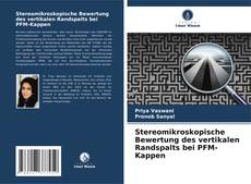 Stereomikroskopische Bewertung des vertikalen Randspalts bei PFM-Kappen kitap kapağı