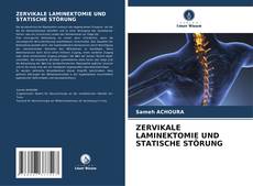 Bookcover of ZERVIKALE LAMINEKTOMIE UND STATISCHE STÖRUNG