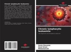 Chronic lymphocytic leukaemia: kitap kapağı
