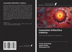 Leucemia linfocítica crónica: kitap kapağı