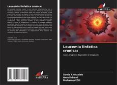 Leucemia linfatica cronica: kitap kapağı
