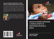 Buchcover von MALOCCLUSIONE ANTERIORE A MORSO APERTO IN DENTIZIONE DECIDUA E MISTA