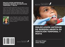 Buchcover von MALOCLUSIÓN ANTERIOR DE MORDIDA ABIERTA EN DENTICIÓN TEMPORAL Y MIXTA