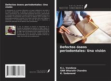 Buchcover von Defectos óseos periodontales: Una visión