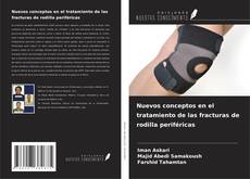 Bookcover of Nuevos conceptos en el tratamiento de las fracturas de rodilla periféricas
