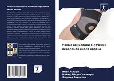 Bookcover of Новые концепции в лечении переломов около колена