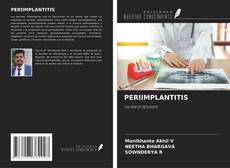 Buchcover von PERIIMPLANTITIS