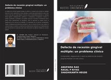 Bookcover of Defecto de recesión gingival múltiple: un problema clínico