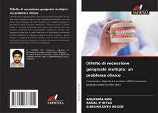 Buchcover von Difetto di recessione gengivale multipla: un problema clinico