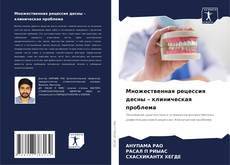 Portada del libro de Множественная рецессия десны – клиническая проблема