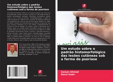 Bookcover of Um estudo sobre o padrão histomorfológico das lesões cutâneas sob a forma de psoríase