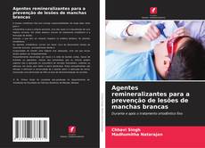 Bookcover of Agentes remineralizantes para a prevenção de lesões de manchas brancas