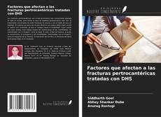 Bookcover of Factores que afectan a las fracturas pertrocantéricas tratadas con DHS