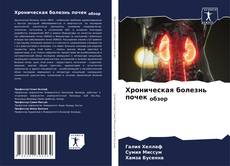 Bookcover of Хроническая болезнь почек обзор