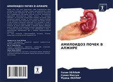 Portada del libro de АМИЛОИДОЗ ПОЧЕК В АЛЖИРЕ