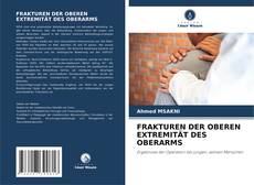 Bookcover of FRAKTUREN DER OBEREN EXTREMITÄT DES OBERARMS