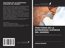 Capa do livro de FRACTURAS DE LA EXTREMIDAD SUPERIOR DEL HÚMERO 