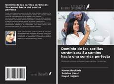 Bookcover of Dominio de las carillas cerámicas: Su camino hacia una sonrisa perfecta