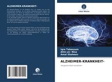Bookcover of ALZHEIMER-KRANKHEIT-