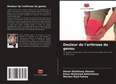 Bookcover of Douleur de l'arthrose du genou