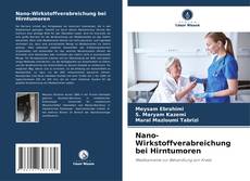 Buchcover von Nano-Wirkstoffverabreichung bei Hirntumoren