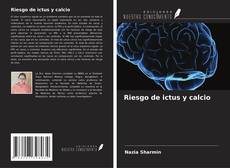 Buchcover von Riesgo de ictus y calcio
