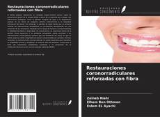 Bookcover of Restauraciones coronorradiculares reforzadas con fibra