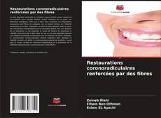 Bookcover of Restaurations coronoradiculaires renforcées par des fibres