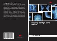 Buchcover von Imaging benign bone tumors