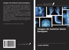 Capa do livro de Imagen de tumores óseos benignos 