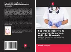 Bookcover of Superar os desafios da reconstituição corono-radicular fibrosada