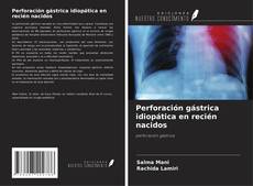 Bookcover of Perforación gástrica idiopática en recién nacidos