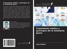 Bookcover of Tratamiento médico y quirúrgico de la miastenia grave