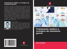 Bookcover of Tratamento médico e cirúrgico da miastenia gravis