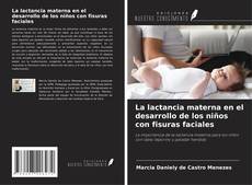 Bookcover of La lactancia materna en el desarrollo de los niños con fisuras faciales