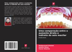 Bookcover of Uma comparação entre o aumento direto e indireto do seio maxilar